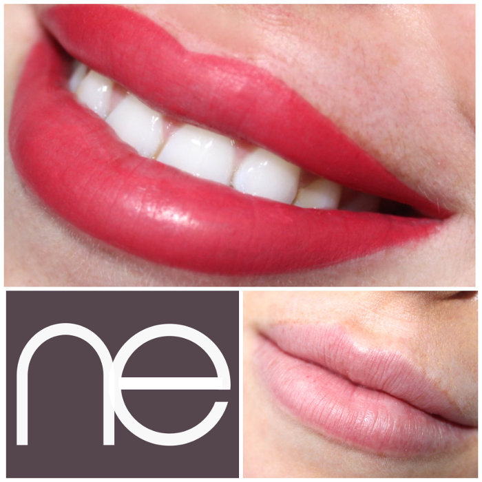 Natural Enhancement Lips Natural Enhancement Lips